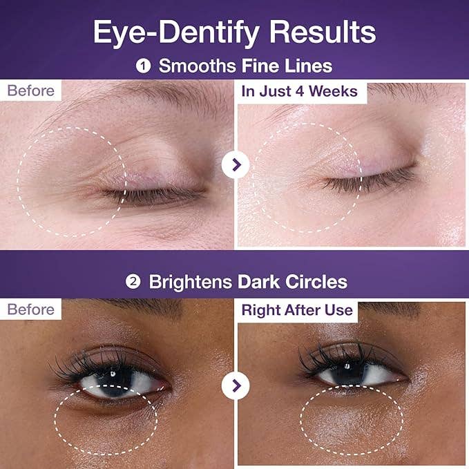 Crème Contour des Yeux Coréenne – Anti-Rides, Cernes & Poches (Regard Lisse & Lumineux)